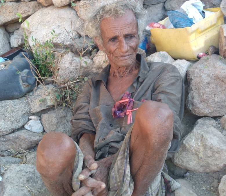 The missing hope of the Yemeni people and the long-awaited dream