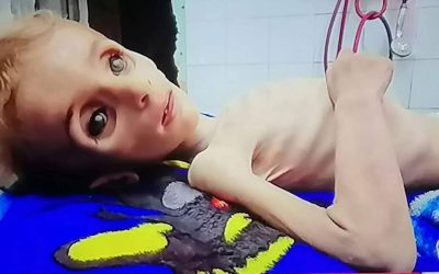 Starving and bombed in a ‘safe’ zone in Gaza